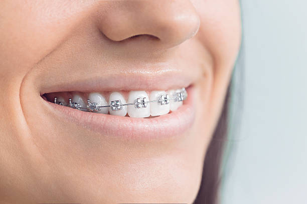 Best Dental Fillings (Composite and Amalgam)  in Rockport, IN